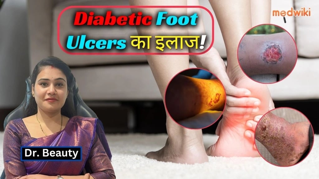 Diabetic Foot Ulcers का इलाज: Effective Methods & Prevention Tips!