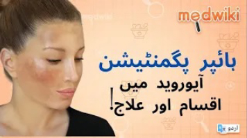 آ یوروید میں جھائی (ہائپر پگمنٹیشن) کی اقسام اور علاج