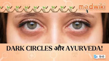 Dark Circles और Ayurveda!
