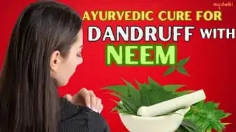 Ayurvedic Cure for Dandruff with Neem Leaves