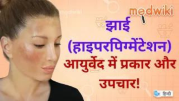 झाई हाइपरपिग्मेंटेशन आयुर्वेद में प्रकार और उपचार!