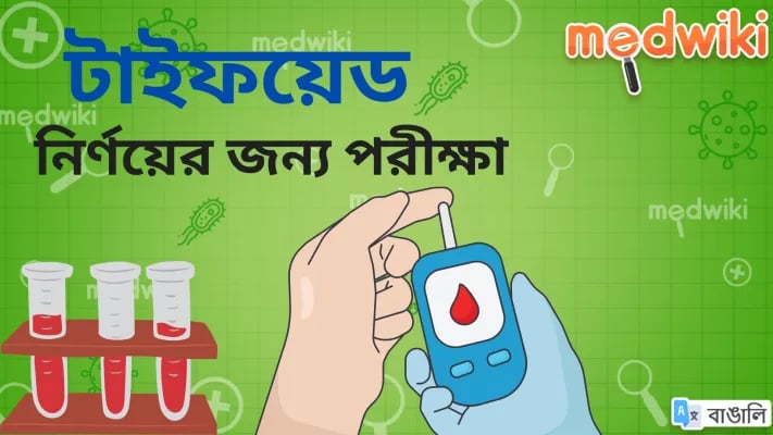 টাইফয়েড নির্ণয়ের পরীক্ষা!