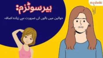 ہیرسوٹزم: خواتین میں بالوں کی ضرورت سے زیادہ اضافہ