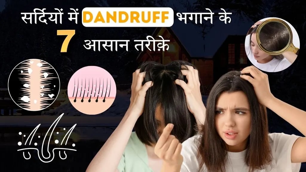 Dandruff हटाने के Simple और Effective Home Remedies | Winter Tips!