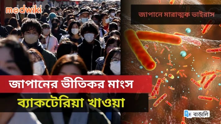 মাংস খাওয়া ব্যাকটেরিয়া: সংক্রমণ যা আপনাকে 48 ঘন্টার মধ্যে মেরে ফেলতে পারে!