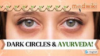 Dark Circles & Ayurveda