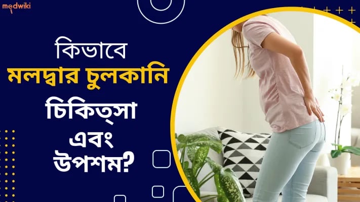 কিভাবে মলদ্বার চুলকানি চিকিত্সা এবং উপশম?