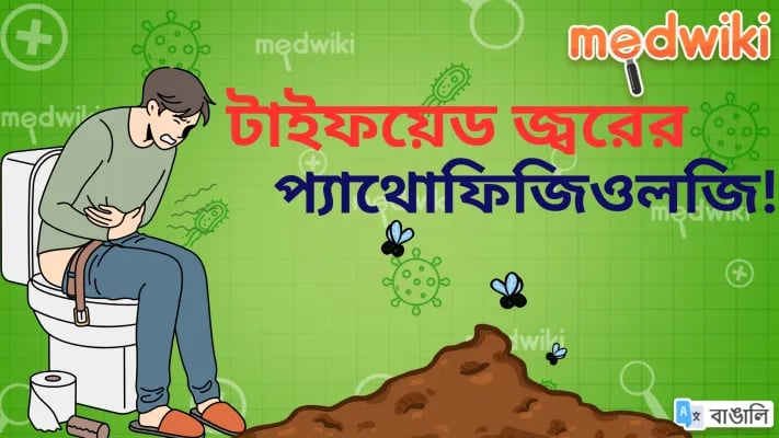 টাইফয়েড জ্বরের প্যাথোফিজিওলজি!