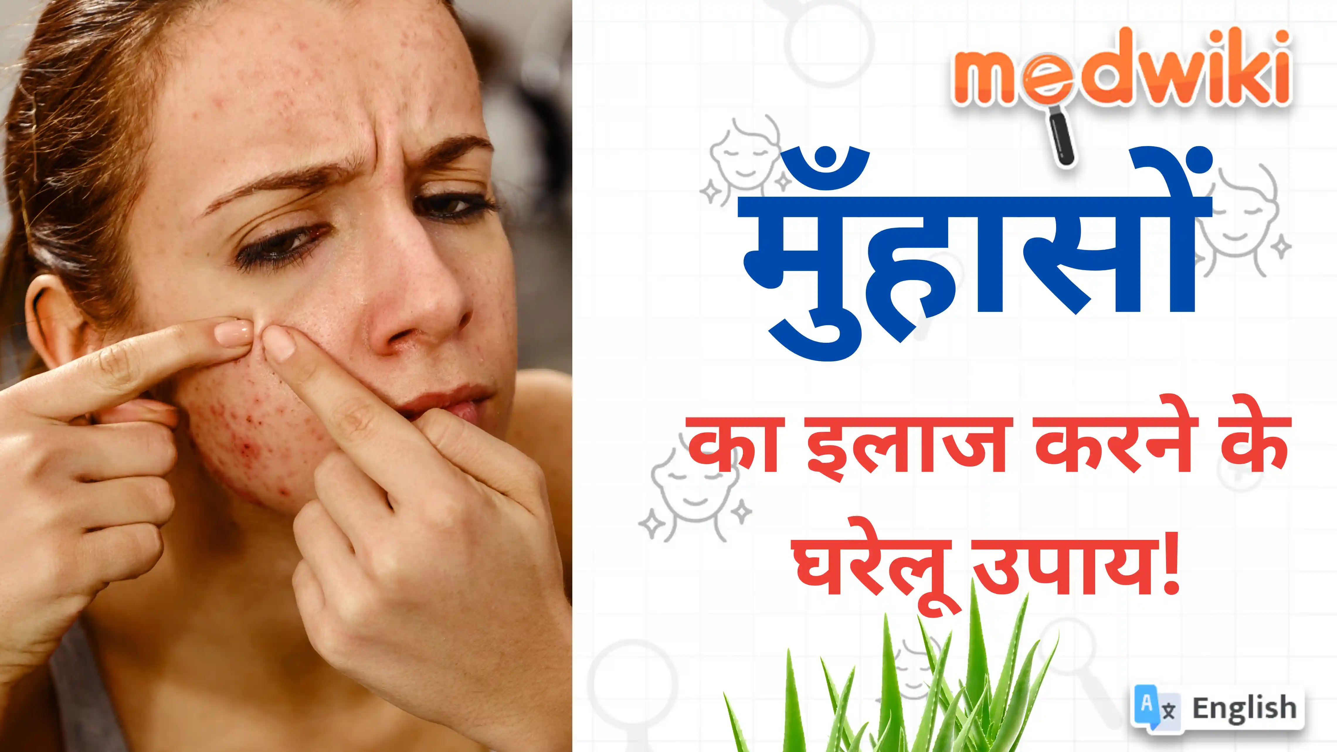 मुँहासों का इलाज करने के घरेलू उपाय!