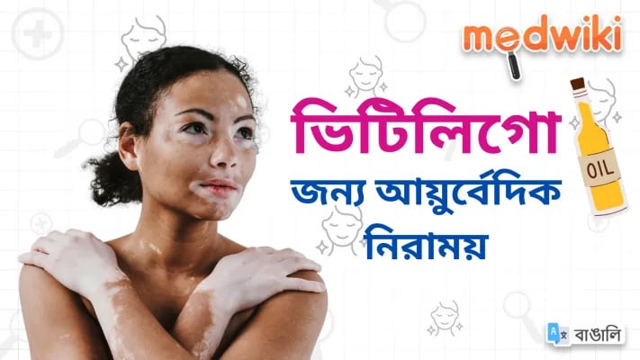 ভিটিলিগোর আয়ুর্বেদিক নিরাময়!