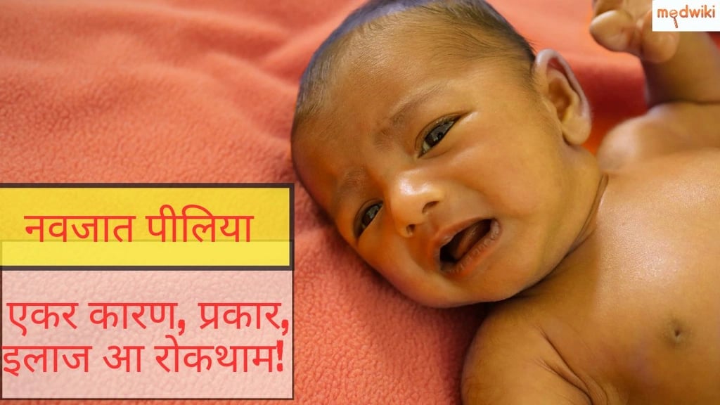 नवजात पीलिया : एकर कारण, प्रकार, इलाज आ रोकथाम!