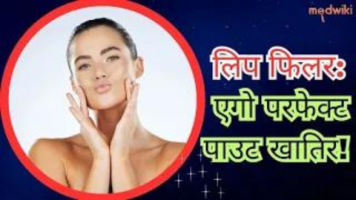 लिप फिलर: एगो परफेक्ट पाउट खातिर!