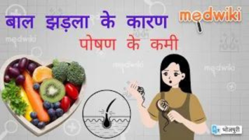 बाल झड़ला के कारण | पोषण के कमी बाल झड़ला के प्रमुख कारण होला !