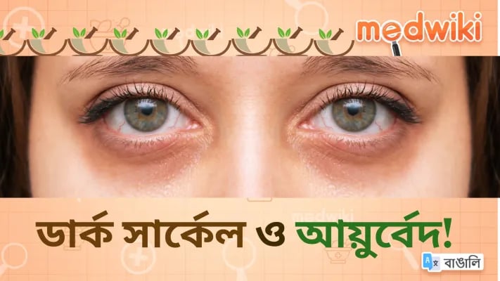 ডার্ক সার্কেল ও আয়ুর্বেদ!