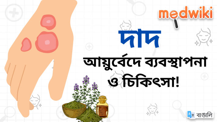 দাদ: আয়ুর্বেদে ব্যবস্থাপনা ও চিকিৎসা!