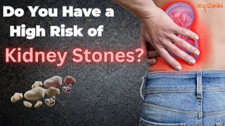 Do You Have a High Risk of Kidney Stones?