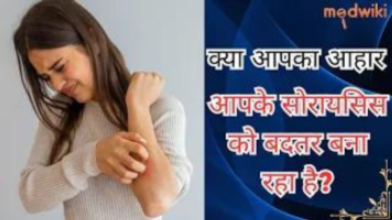 क्या आपका आहार आपके सोरायसिस को बदतर बना रहा है