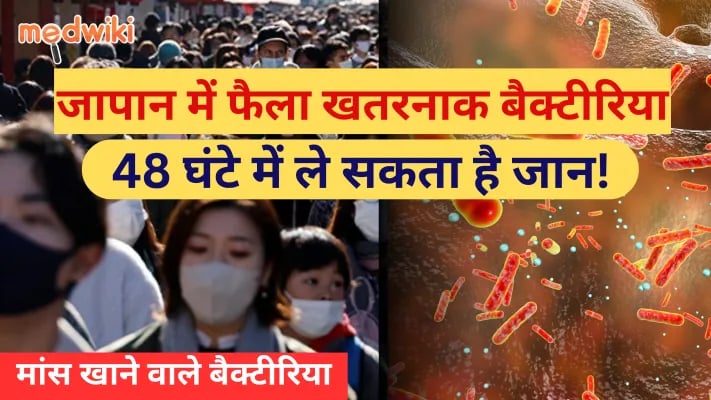 मांस खाने वाले बैक्टीरिया संक्रमण जो 48 घंटों में आपको मार सकता है!