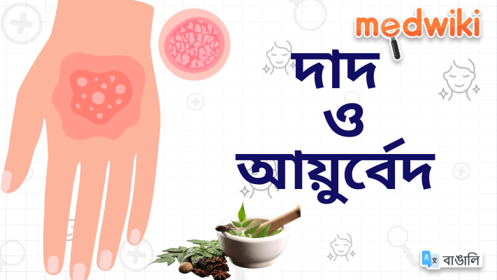 দাদ এবং আয়ুর্বেদ: একটি সংক্ষিপ্ত বিবরণ!