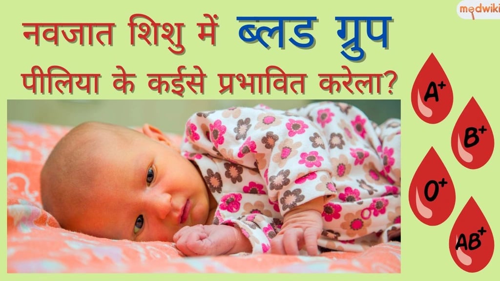 नवजात शिशु में ब्लड ग्रुप पीलिया के कईसे प्रभावित करेला!
