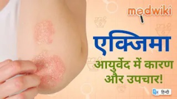 एक्जिमा आयुर्वेद में कारण और उपचार