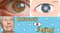 Cataracts and Aging: What to Know