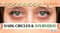 Dark Circles & Ayurveda