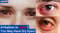 What Causes Dry Eyes All of a Sudden? Causes of Dry and Irritated Eyes! 