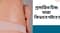 প্রসারিত চিহ্ন: তারা কিভাবে ঘটবে?