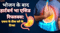 भोजन के बाद हार्टबर्न भा एसिड रिफ्लक्स!