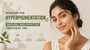 Skincare for Hyperpigmentation: Natural and Effective Treatment Tips!