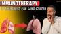 Immunotherapy: A Treatment For Lung Cancer