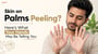 Skin on Palms Peeling? Here’s What Your Hands May Be Telling You!