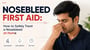 Nosebleed First Aid: How to Safely Treat a Nosebleed at Home
