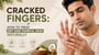 Cracked Fingers: How to Treat Dry and Painful Skin Naturally!