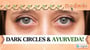 Dark Circles & Ayurveda