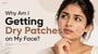 Why Am I Getting Dry Patches on My Face?