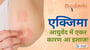 एक्जिमा : आयुर्वेद में एकर कारण आ इलाज!