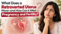 What Does a Retroverted Uterus Mean and How Can It Affect Pregnancy and Fertility?