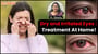 5 Simple home remedies for dry & irritated eyes| Treat dry and irritated eyes without any medicine!