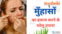मुँहासों का इलाज करने के घरेलू उपाय!