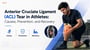 Anterior Cruciate Ligament (ACL) Tear in Athletes: Causes, Prevention, and Recovery!