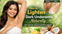 How to Lighten Dark Underarms Naturally with Gentle Home Care Remedies?