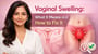 Vaginal Swelling: What It Means and How to Fix It!