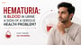 Hematuria: Is Blood in Urine a Sign of a Serious Health Problem?