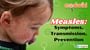 Measles Symptoms, Transmission, Prevention!