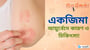 একজিমা: আয়ুর্বেদে কারণ ও চিকিৎসা!