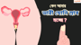 কেন আমার ভারী যোনি স্রাব হচ্ছে?
