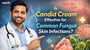 Is Candid Cream Effective for Common Fungal Skin Infections?