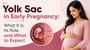 Yolk Sac in Early Pregnancy: What It Is, Its Role, and What to Expect